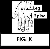Illustration of Acupuncture points.
