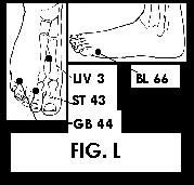 Illustration of Acupuncture points.