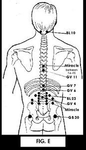 Illustration of Acupuncture points.