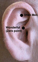 Acupuncture points of the ear for treating chronic pain.