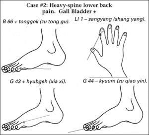 Diagram showing acupuncture points of foot, toes and fingers.