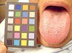 Man's tongue and calibration chart.