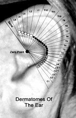 Acupuncture Technique
