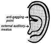 Anti-gagging point, left ear.