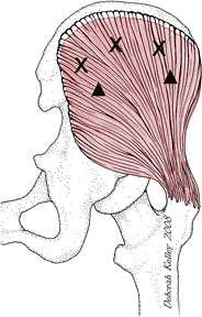 Illustration Gluteus Medius V1