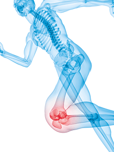 Trigger Points for Runner's Knee