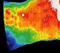 Infrared image of back, before treatment.