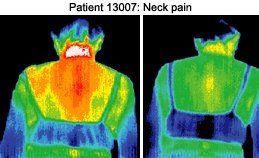 Infrared images of patient.