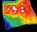 Infrared image of back, immediately after moxibustion.
