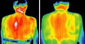 Infrared images of patient.