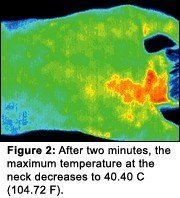 Infrared image #2 of upper back pain.