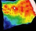 Infrared image of back, two minutes after treatment.