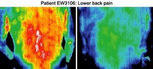 Infrared images of patient.