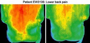 Infrared images of patient.