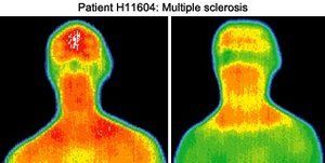 Infrared images of patient.