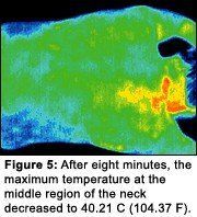 Infrared image #5 of upper back pain.