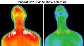 Infrared images of patient.