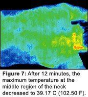 Infrared image #7 of upper back pain.