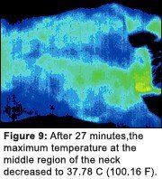 Infrared image #9 of upper back pain.