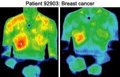 Infrared images of patient.