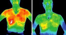 Infrared images of patient.