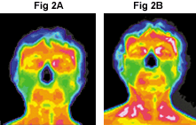 FIG 2A and 2B