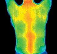 Thermogram of the back of a very healthy woman.
