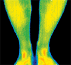 Infared image of lower legs and feet.
