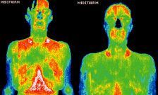 Infrared images showing body surface temperature distribution.