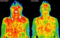 Infrared images showing body surface temperature distribution.