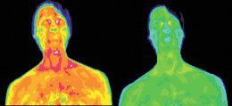 Infrared images of the face and shoulder of a male with genital herpes.