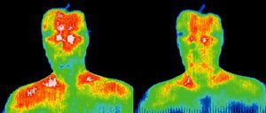 Infrared images showing body surface temperature distribution.