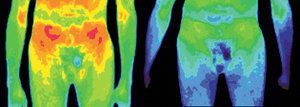 Infrared images of the lower frontal surface of a patient.