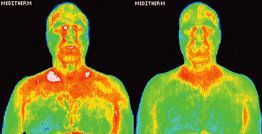 Infrared images showing body surface temperature distribution.