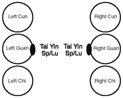Tai yin channel involvement in a 73-year-old patient.