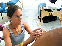 acupuncture