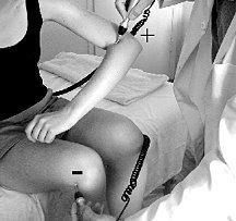 Woman receiving electric acupuncture to her elbow and knee.