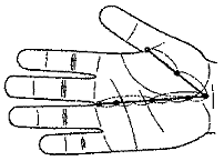 Basic moxa points on the yin surface of the hand.