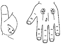 Heart and kidney corresponding areas.