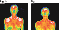 Yin Lo Infrared Images
