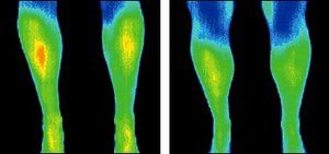 Infrared images of legs. - Copyright – Stock Photo / Register Mark