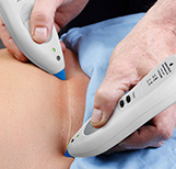 Release Abdominal Scars
